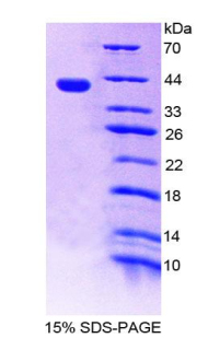 RPA962Hu01.jpg