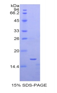 RPA966Hu02.jpg