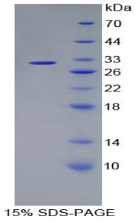 Recombinant Kallikrein 1 (KLK1)