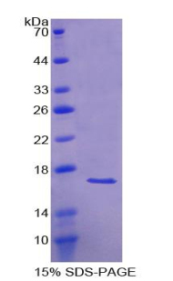 RPA969Hu01.jpg