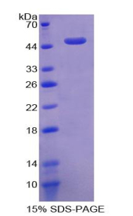 RPA969Hu02.jpg