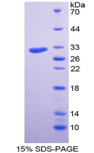 RPA974Hu01.jpg