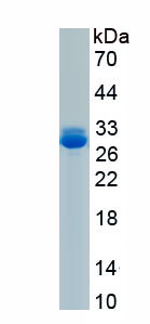 Recombinant Retinoic Acid Receptor Alpha (RARa)