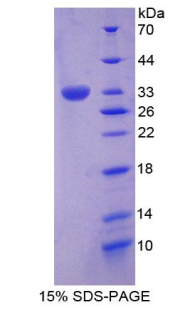 RPA984Hu01.jpg