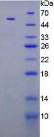 RPA987Hu01.jpg