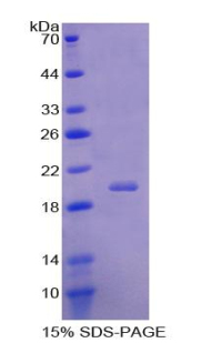 RPA994Hu01.jpg