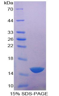 RPA994Hu02.jpg