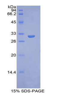 RPA998Hu01.jpg