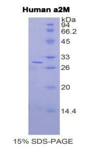 Recombinant Alpha-2-Macroglobulin (a2M)