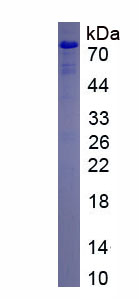 Recombinant Beta Catenin (β-catenin)