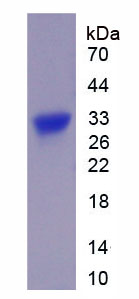 Recombinant Beta Catenin (β-catenin)