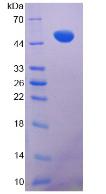 Recombinant Vimentin (VIM)