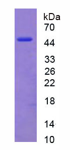 Recombinant Vimentin (VIM)