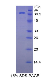 RPB062Hu02.jpg