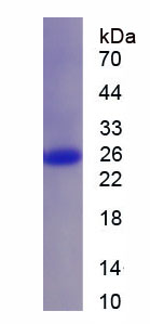 Recombinant Glutathione S Transferase Pi (GSTp)