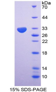 RPB110Hu01.jpg