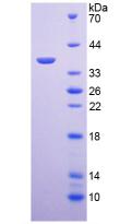 Recombinant Arginase (ARG)