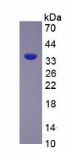 Recombinant Arginase (ARG)