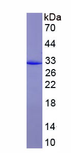 Recombinant Deoxyribonuclease I (DNASE1)