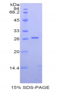 RPB144Hu01.jpg