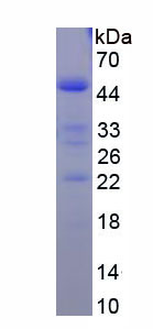 RPB144Hu02.jpg