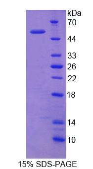 Recombinant Integrin Alpha X (CD11c)