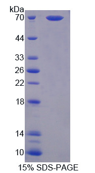 Recombinant Thioredoxin-interacting Protein (TXNIP)