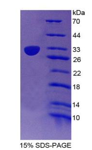 Recombinant Cluster Of Differentiation 1e (CD1e)