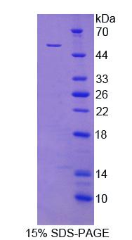 Recombinant Transferrin Receptor (TFR)