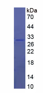 Recombinant Transferrin Receptor (TFR)