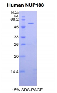 RPB183Hu01.jpg