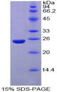 Recombinant Nucleoporin 160 (NUP160)