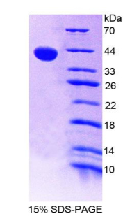 Recombinant Neurokinin B (NKB)