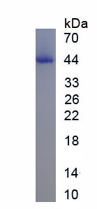 Recombinant Aspartate Aminotransferase (AST)