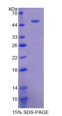 Recombinant Fibrinogen Beta Chain (FGB)