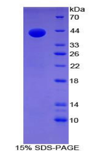 Recombinant Gastrin (GT)