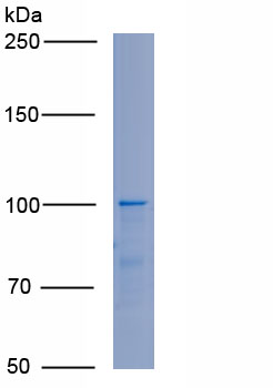 Recombinant Cluster Of Differentiation 56 (CD56)