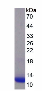 Recombinant Corticosteroid Binding Globulin (CBG)