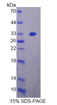 Recombinant Integrin Alpha 2 (ITGa2)