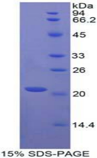 Recombinant Cytotoxic T-Lymphocyte Associated Antigen 4 (CTLA4)