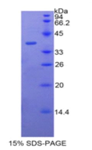 Recombinant Bactericidal/Permeability Increasing Protein (BPI)