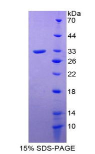 Recombinant Plasminogen (Plg)