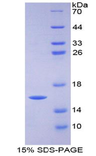 Recombinant Heart-type Fatty Acid Binding Protein (H-FABP)