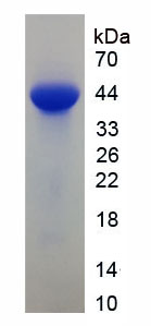 Recombinant Heart-type Fatty Acid Binding Protein (H-FABP)