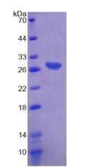 Recombinant Cluster Of Differentiation 72 (CD72)