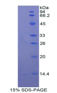 Recombinant Cathepsin D (CTSD)