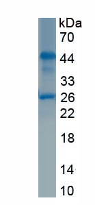 Recombinant Integrin Alpha V (ITGaV)