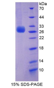 Recombinant Perforin 1 (PRF1)