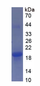 Recombinant Cluster of Differentiation 59 (CD59)