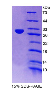 Recombinant Breast Cancer Susceptibility Protein 2 (BRCA2)